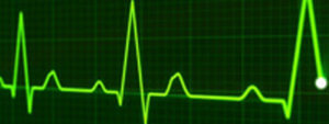 unexplained syncope