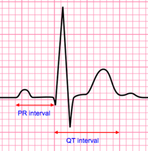 How to Read ECG's