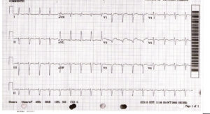 ECG Medical Case of the Month
