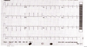 ECG Medical Case of the Month