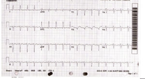 ECG Course