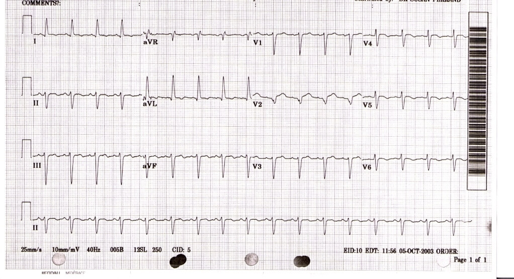 ECG Course