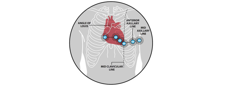 The Basics of ECG Interpretation (Part 1 – Anatomy and Physiology)