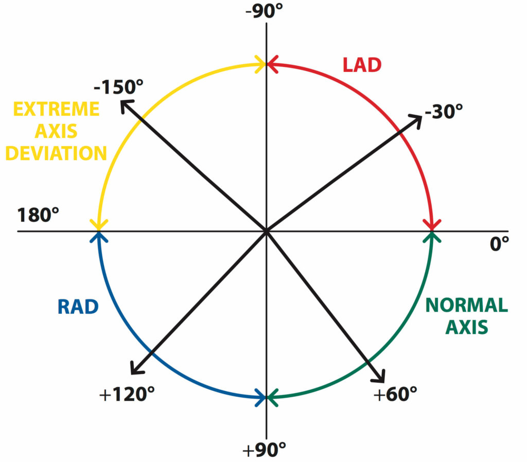 Figure 5. The axis of the ECG. © Medical Exam Prep