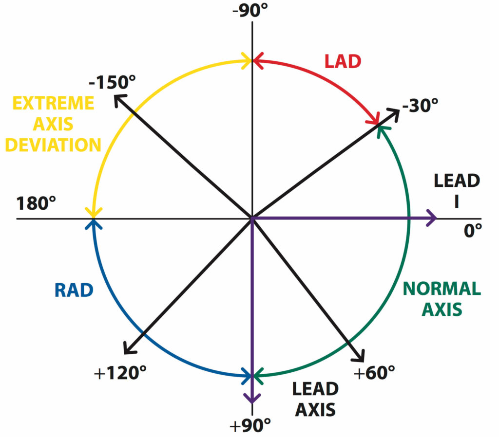 Cardiac Axis Chart