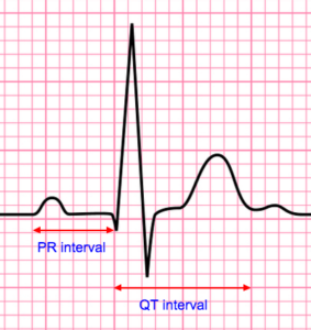 ECG Segments