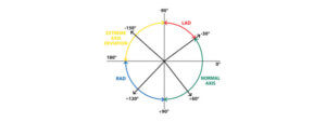 Rate, Rhythm and Axis