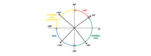 ecg interpret basics_2