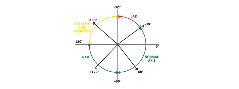 The Basics of ECG Interpretation (Part 2 – Rate, Rhythm and Axis)