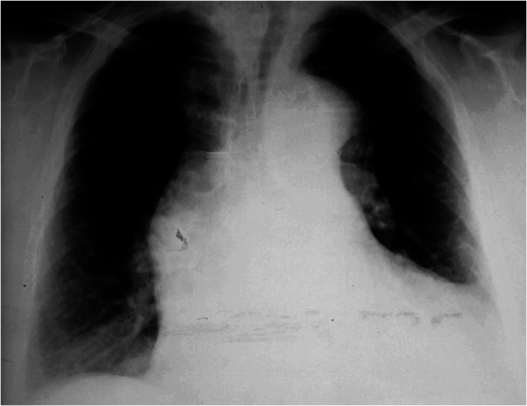 'Ripping’ Chest Pain in a 38YearOld Man Medical Exam Prep