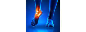 ankle pain