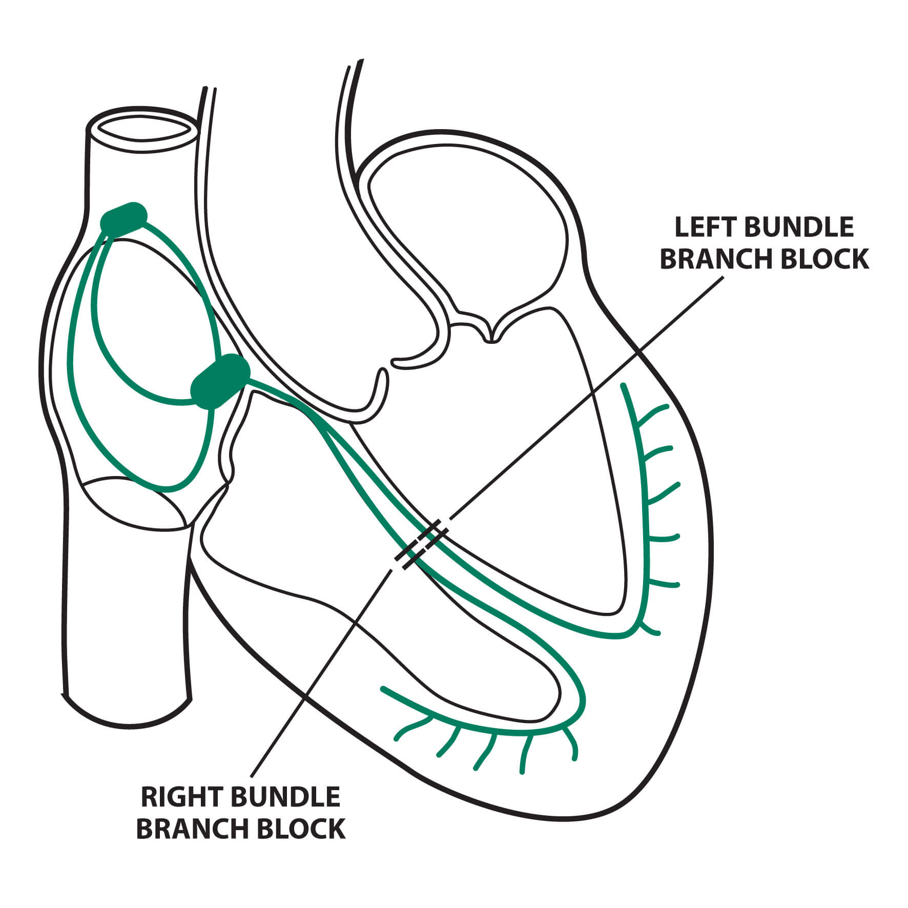 Cardiac Conduction System