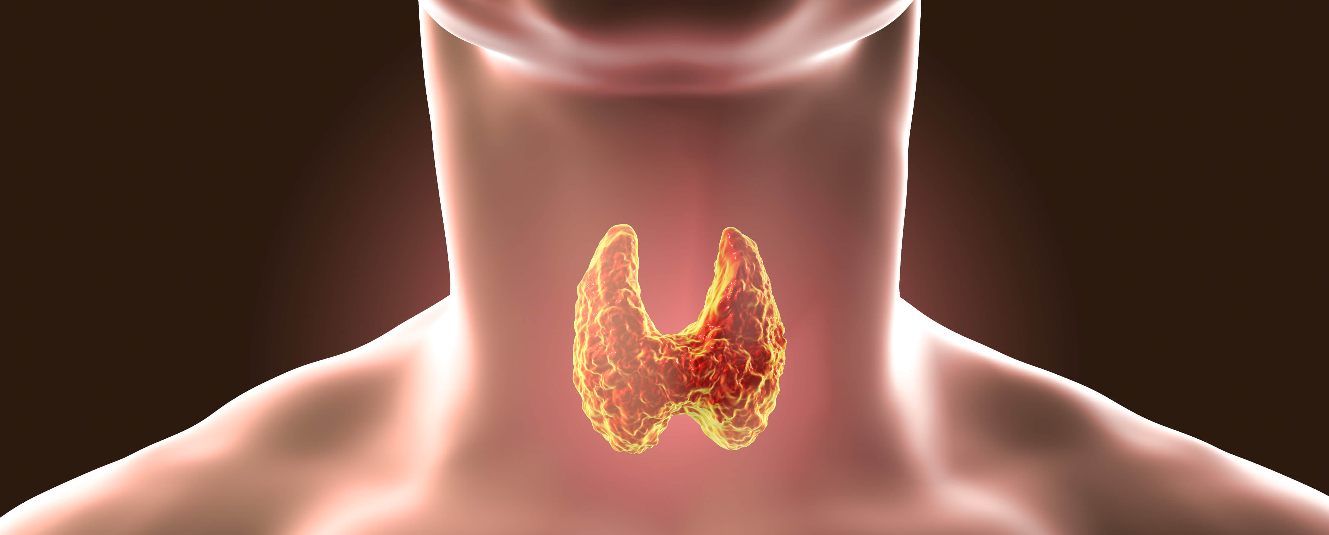 A 67-Year-Old Woman with Agitation and Confusion