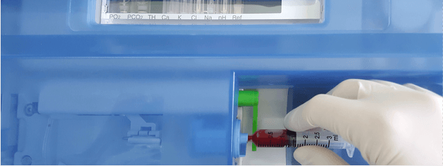 Arterial Blood Gas Analysis Part 2 – Interpreting the Results