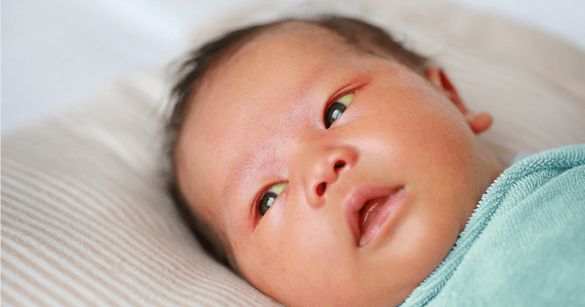 case study of newborn with jaundice