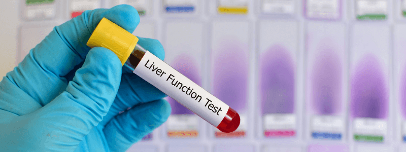 Interpreting Abnormal Liver Function Tests