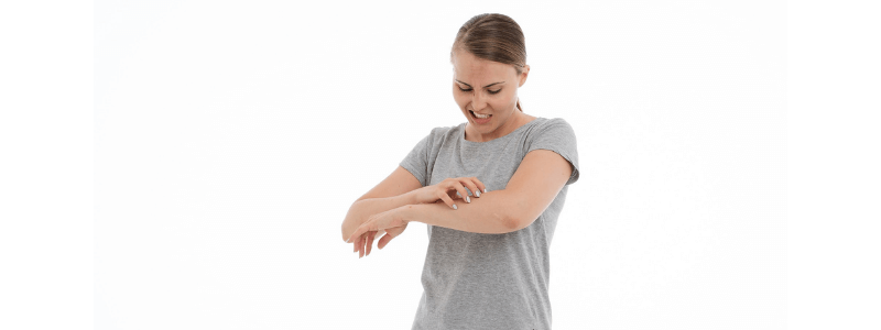 A 21-Year-Old Woman with an Intensely Itchy Rash