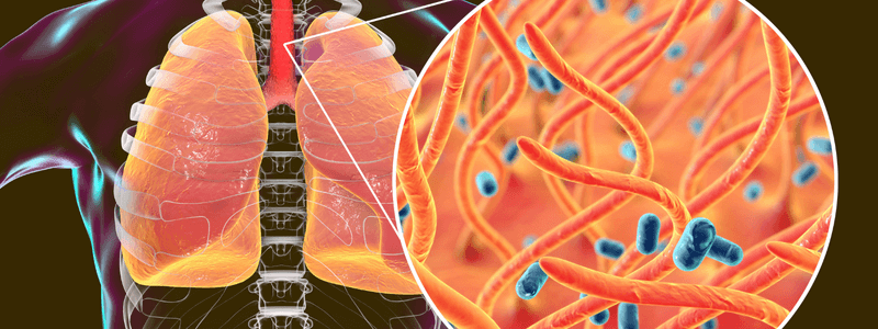 Pertussis