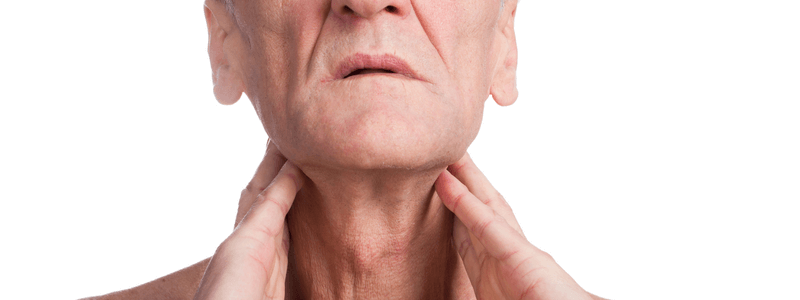 A 73-Year-Old Man with Lumps on His Neck