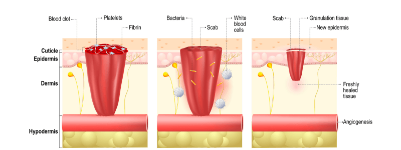 Wound Healing