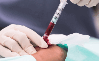 Arterial Blood Gas Analysis – At a Glance