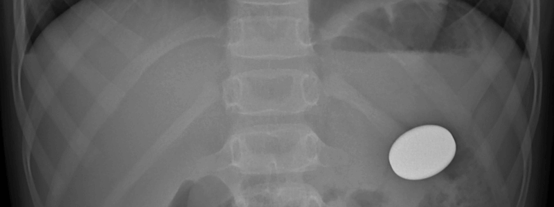 Ingested Foreign Bodies: An Overview