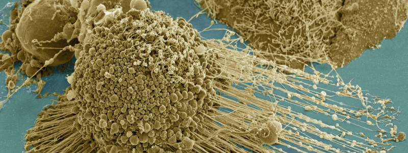 The Immortal cells of Henrietta Lacks